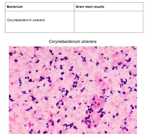 [Solved] Bacterium Gram stain results Corynebacterium ulcerans ...