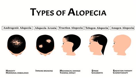 Causes of Alopecia | Dr Batra’s®