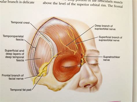 frontal branch of facial nerve | Facial nerve anatomy, Facial nerve ...