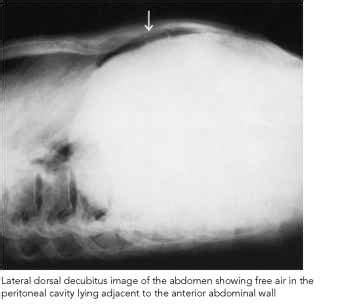 Lateral dorsal decubitus supine - Radiography - Mitch Medical