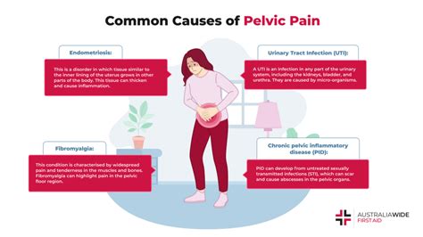 Understanding Chronic Pelvic Pain: Causes And Treatments - Ask The ...