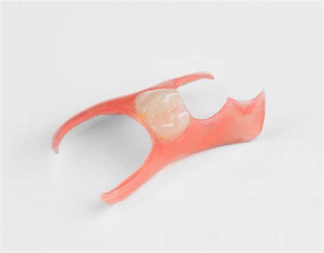 Nesbit Flexible Partial Denture - Dental Lab Direct