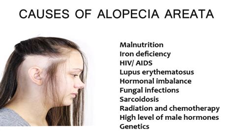 Alopecia Areata