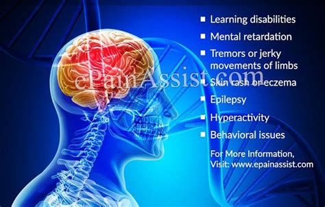 Phenylketonuria – causes, diagnosis, treatment. Diet in phenylketonuria ...