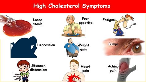 9 High Cholesterol Symptoms! What are High Cholesterol Signs & Symptoms ...