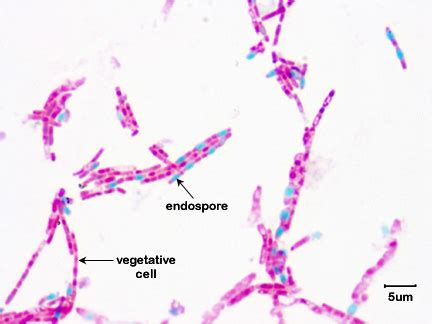 BIOL 230 Lab Manual:Endospore Stain of Bacillus megaterium