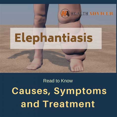 Elephantiasis : Causes, Symptoms, Treatment and Prevention