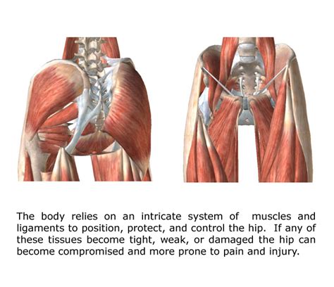 Hip Pain - Gray Chiropractic St.Catharines Spine & Joint Clinic