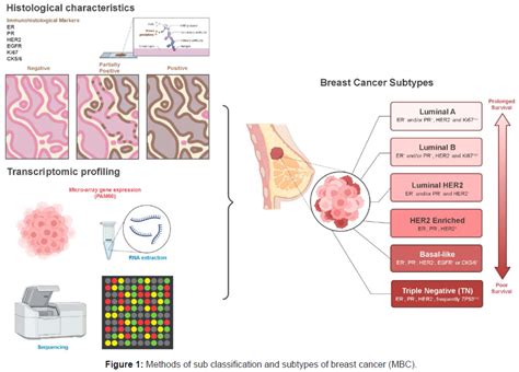 Journal of Cancer Diagnosis - Metaplastic Breast Cancer: Current ...