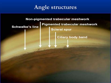 Gonioscopy presentation