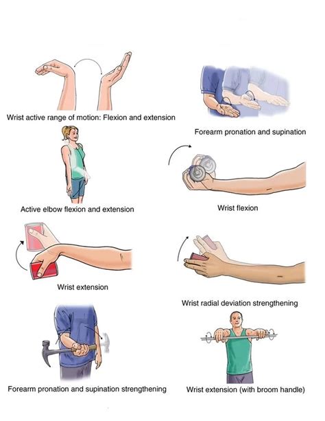 14 Best Home Exercise for Wrist Drop - Mobile Physio