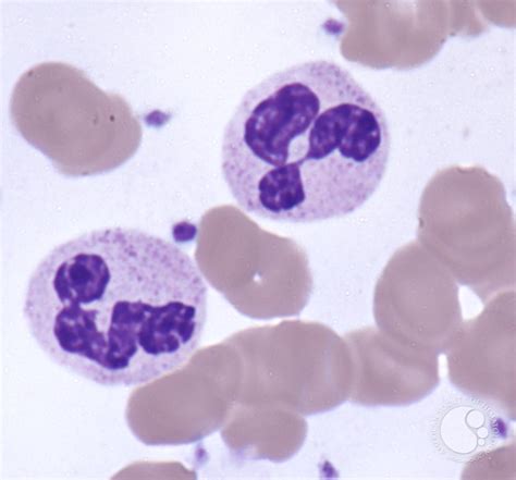 Neutrophils