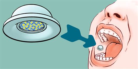 How a suction cup delivers medications to the bloodstream - Pharma ...