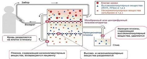 Plasmapheresis for psoriasis: reviews, prices, side effects