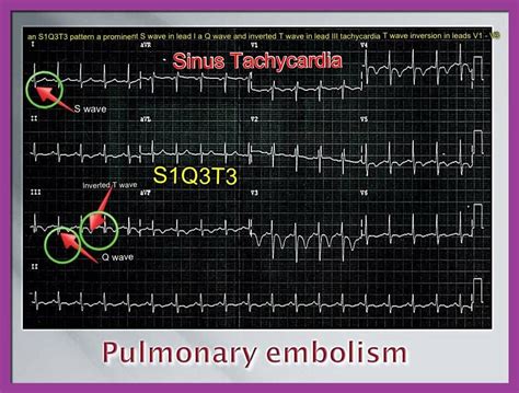 Pin on Nursing•Positive-Med