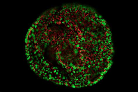 Organoids and 3D Cell Culture | Applications | Leica Microsystems