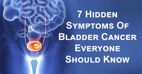 7 Hidden Symptoms Of Bladder Cancer Everyone Should Know - David ...