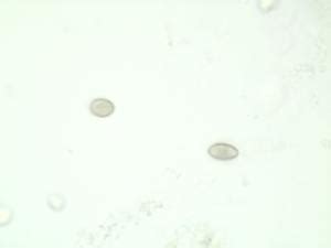 Clonorchis sinensis, Egg, whole mount slides | Boreal Science