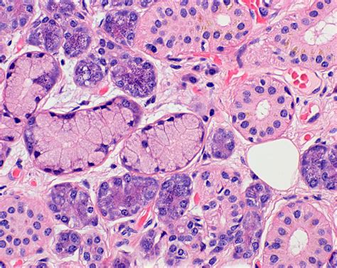 Parotid Salivary Gland Histology Histology Slides Salivary Gland | The ...