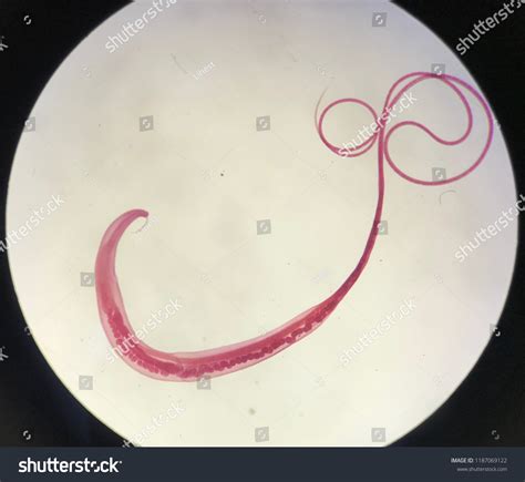 Trichuris trichiura 470 รายการ ภาพ ภาพสต็อกและเวกเตอร์ | Shutterstock