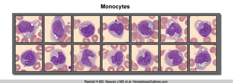 Difference Between Monocytes And Lymphocytes