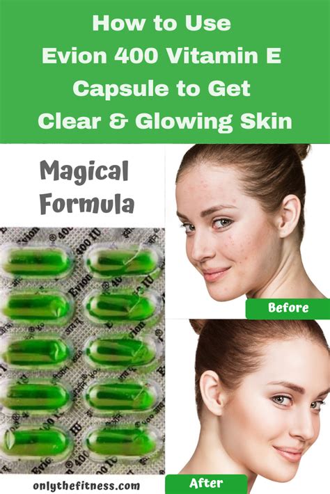 How to use evion 400 vitamin e capsule to get clear and glowing skin ...