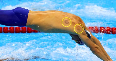 ‘Spotted’ Michael Phelps: ‘Cupping’ Has an Olympic Moment at Rio