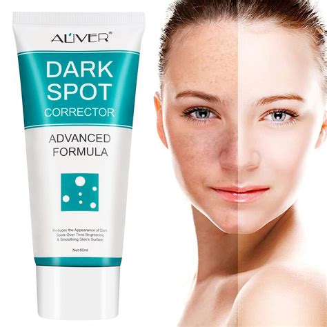 Buy Dark Spot Remover for Face, Dark Spot Corrector Cream, Fade Out The ...