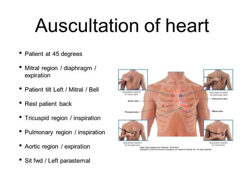 Aortic Regurgitation Murmur