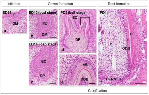 Stages Of Tooth Development Histology