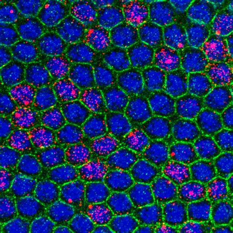 Regulation of gene expression during development – IGMM