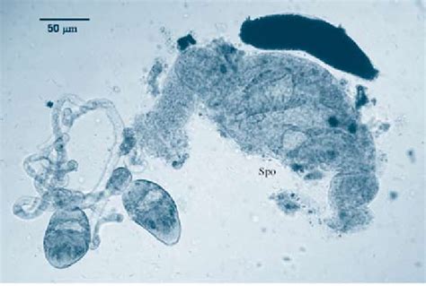 Light microscope photograph of bucephalid sporocyst. (Spo: sporocyst ...