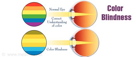 Color Blindness | Global Events | USA| Europe | Middle East| Asia Pacific