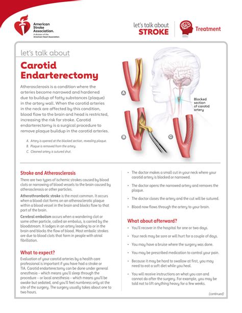 Text - Let's Talk About Carotid Endarterectomy - HealthClips Online