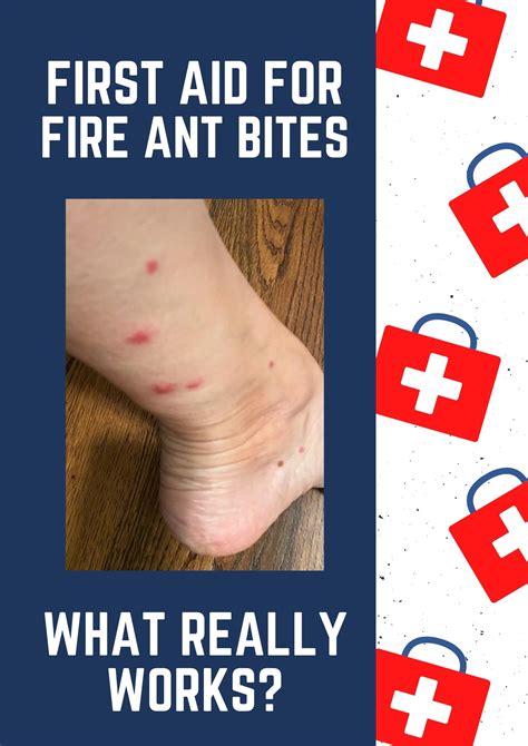 Fire Ant Bites Pictures - Austra Health