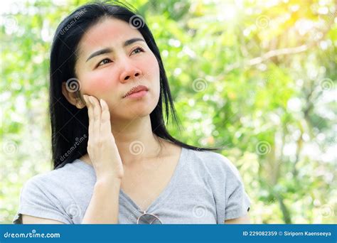 Asian Woman Having Face Skin Problem with Sunburn Redness from ...