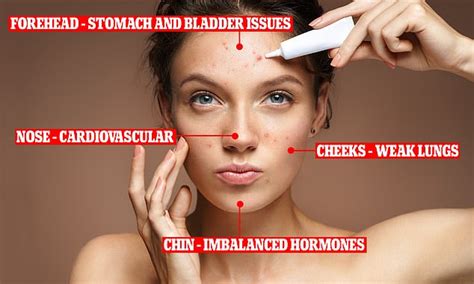 The reasons why you're getting breakouts and how to fix them | Daily ...