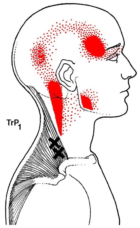 Get To Know Your Muscles: Upper Trapezius — Kinfolk Physiotherapy ...