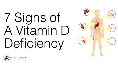 symptoms of vitamin d deficiency - symptoms of vitamin d deficiency