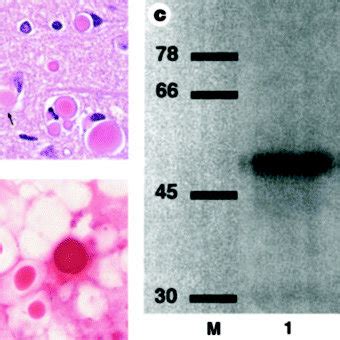 Identification, purification and composition of Collins bodies.a ...