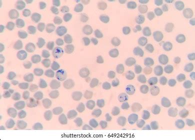 Reticulocyte New Methylene Blue Staining Stock Photo 649242916 ...