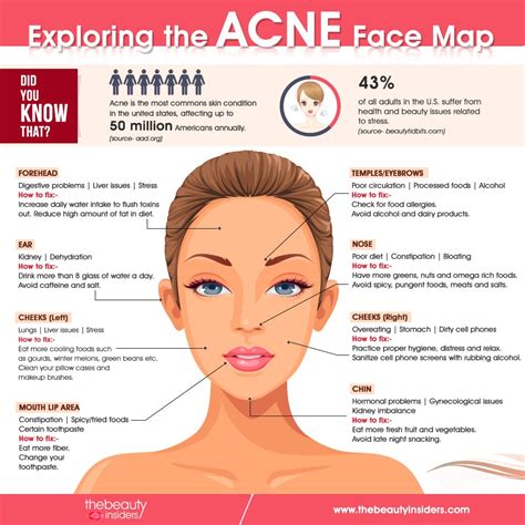 Acne Face Map: Know what does acne reveal about your health | by Mia ...