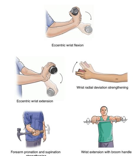 Elbow Extension And Flexion Exercises at Robbin Nosal blog