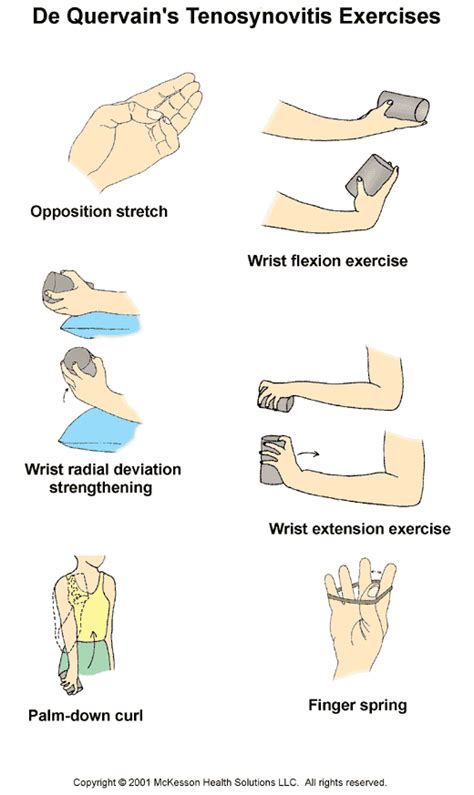 Sports Medicine Advisor 2003.1: De Quervain's Tenosynovitis Exercises ...