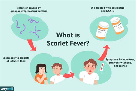 "Swift Rise" In Scarlet Fever Scare In The UK - Asiana Times