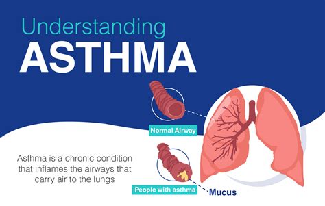 Overview of Asthma: Causes, Symptoms,Types, Risk Factors and its Treatment