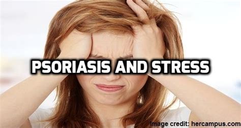 Psoriasis and Stress: The obvious culrit - Psoriasis Self Management