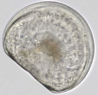 Invertebrate Embryology: Veliger larvae of molluscs