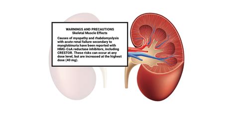 Crestor | Information on Uses, Dosages, Warnings & Recalls