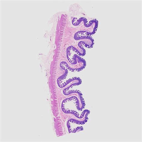 Microscope Sample Slides Typical Histology Slides Muscle Histology ...